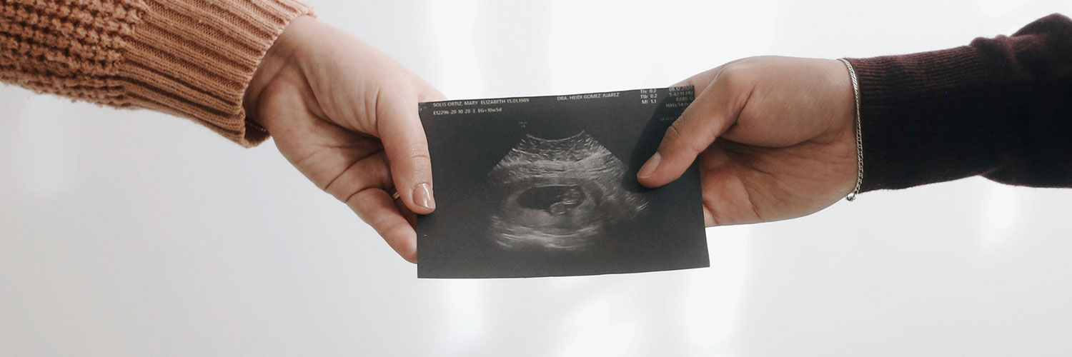 Ecografia d’embaràs sostinguda per dues persones, simbolitzant l’inici d’una nova vida